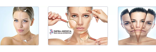 InfraCelltical