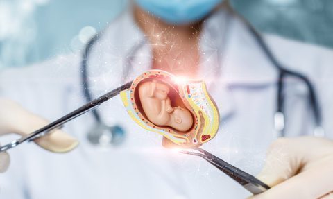 Chicago kolebką aborcyjną dla Amerykanek